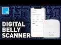 This Digital Scanner Measures BELLY FAT | Future Blink