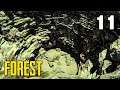 Au fond du trou (Machette) - The Forest #11